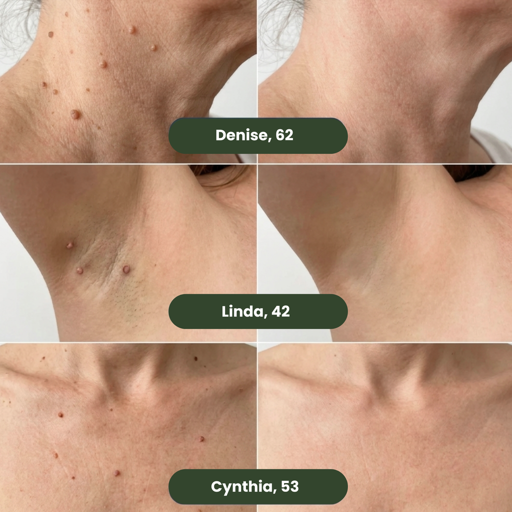 Dermo-active micro-patches new generation