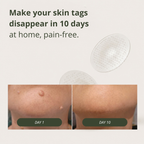 Dermo-active micro-patches new generation